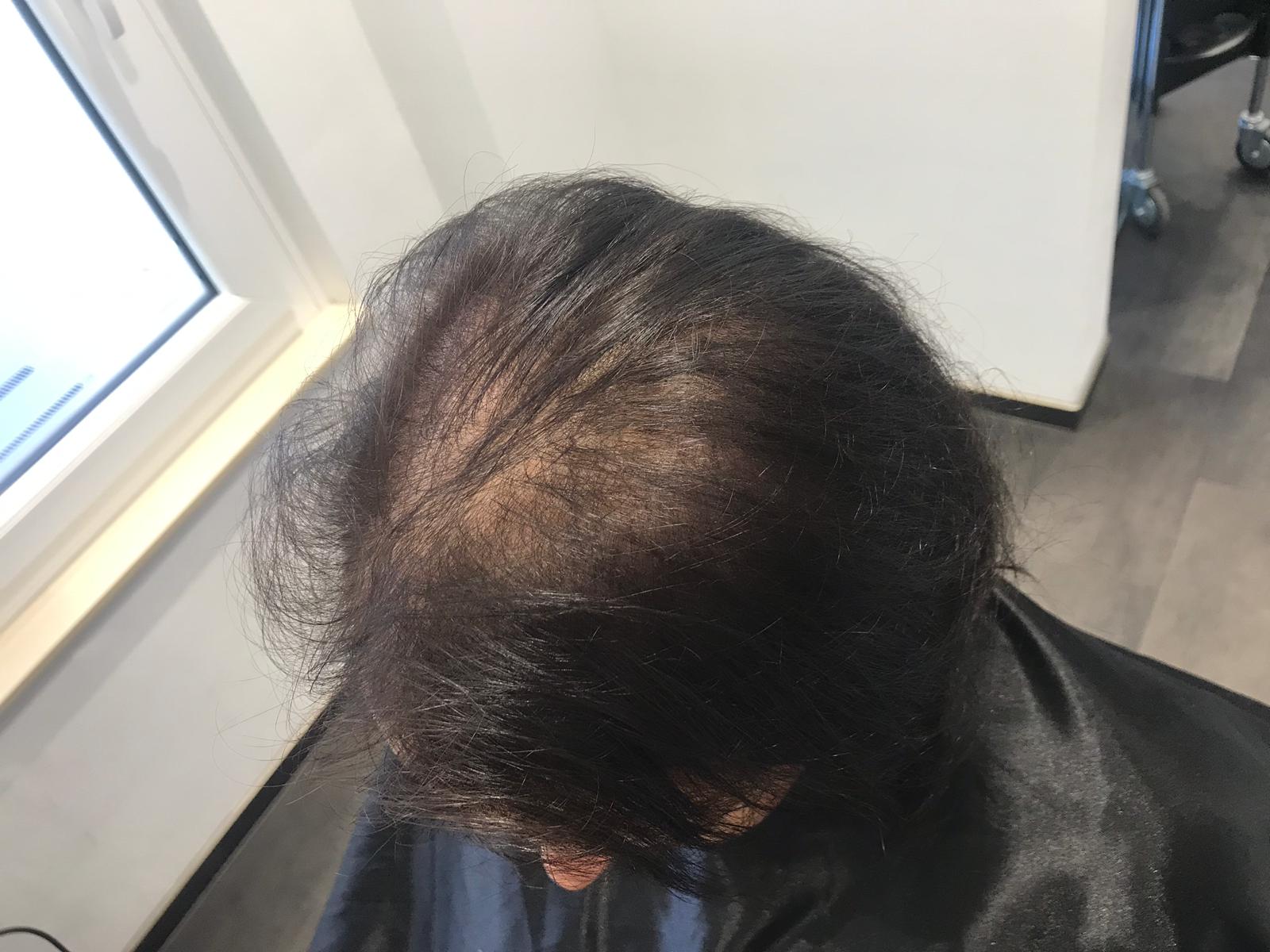 Gl Volume Eine Haarverdichtung Die Neue Massstabe Setzt Friseur Magdeburg